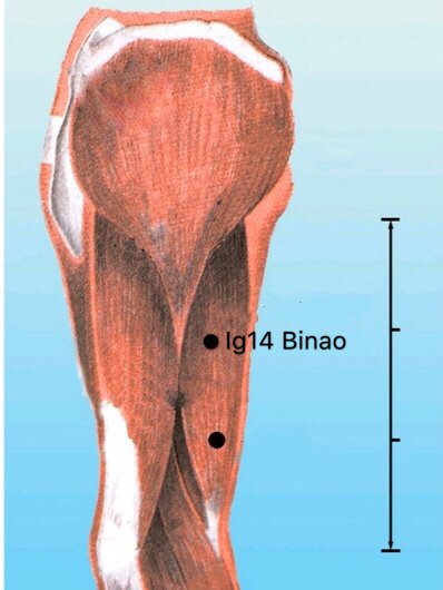 punto ig14 binao anatomia