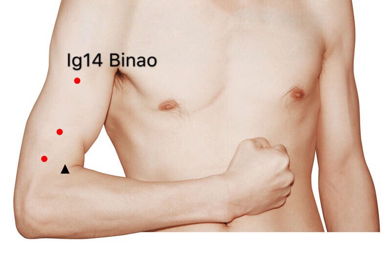 ig14 binao