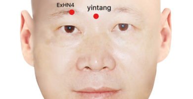 ex-hn3 yintang