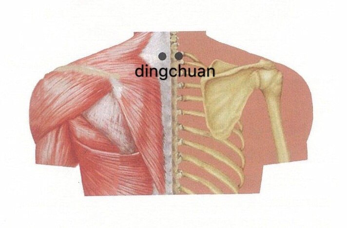 punto anatomica dingchuan