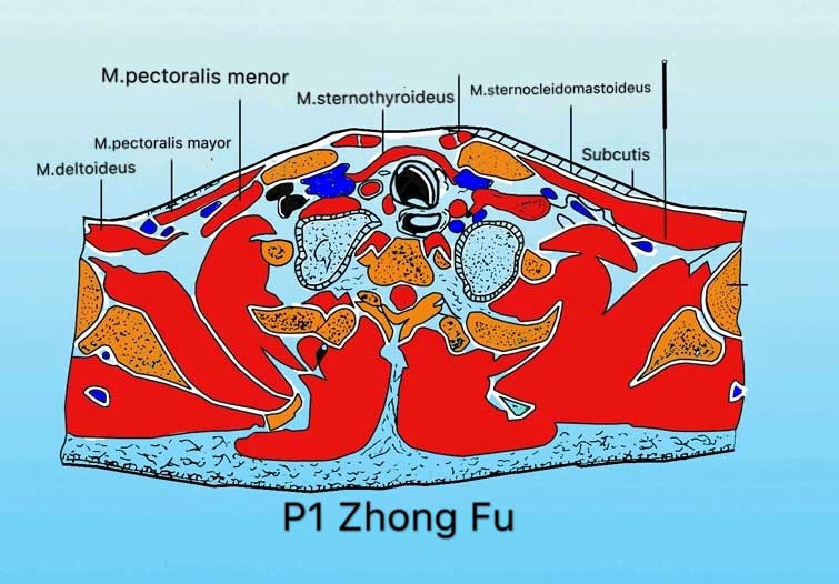 corte transversal punto p1 zhong fu