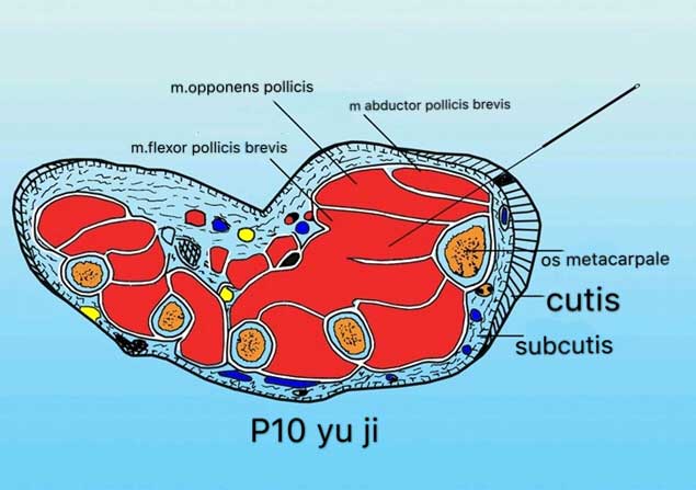 corte transversal del punto p10