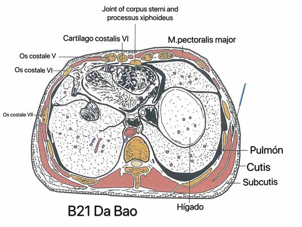 punto bazo21