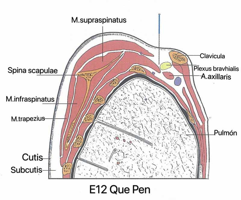 estomago 12 que pen