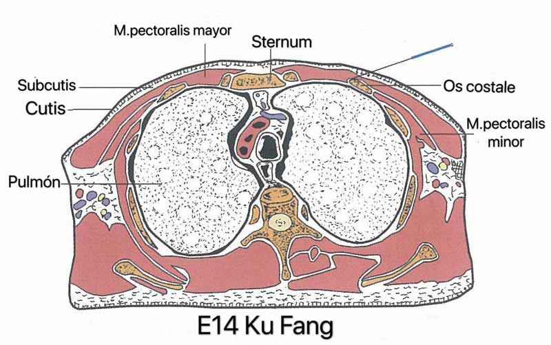 estomago 14 ku fang