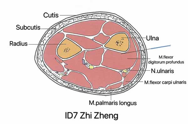 punto intestino delgado 7