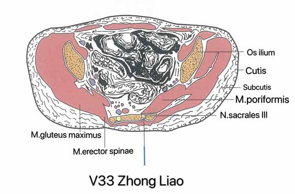 punto vejiga 33