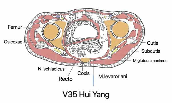 punto vejiga 35