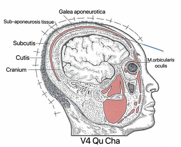 punto vejiga 4