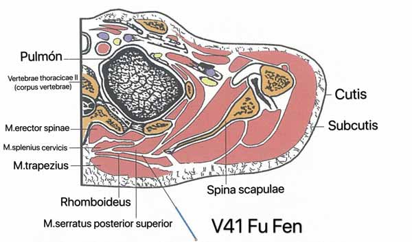 punto vejiga 41