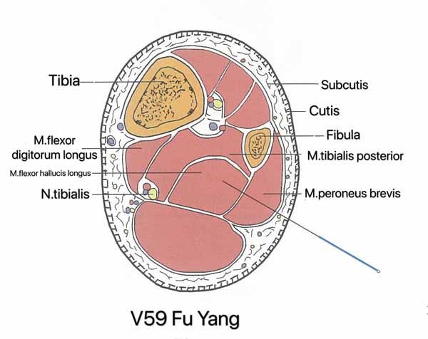 punto vejiga 59