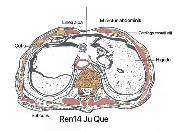 punto ren14