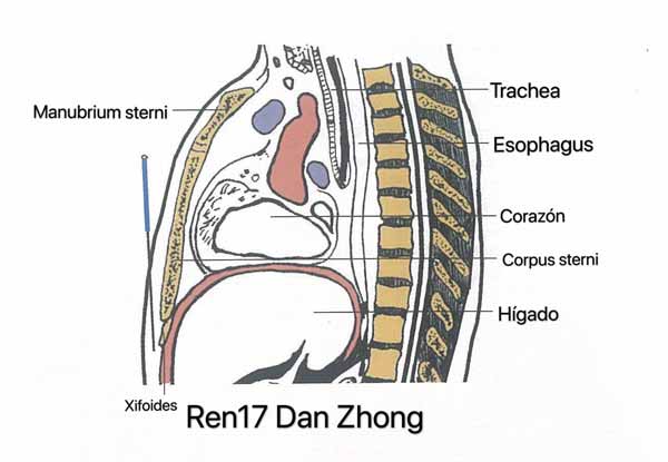 punto ren17