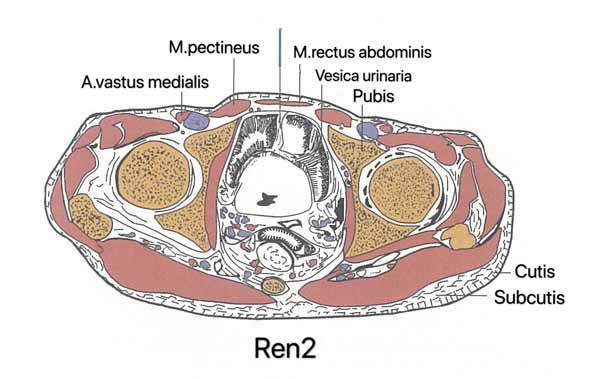 punto ren2